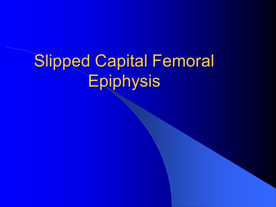 Slipped Capital Femoral Epiphysis (SCFE)
